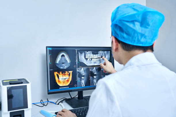 Best Emergency Root Canal Treatment in Pine Castle, FL